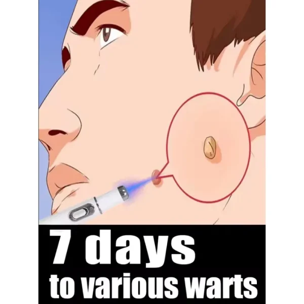 Wart Removal Pen Original for Fast Wart Treatment | wart remover, skin tag remover, wart treatment